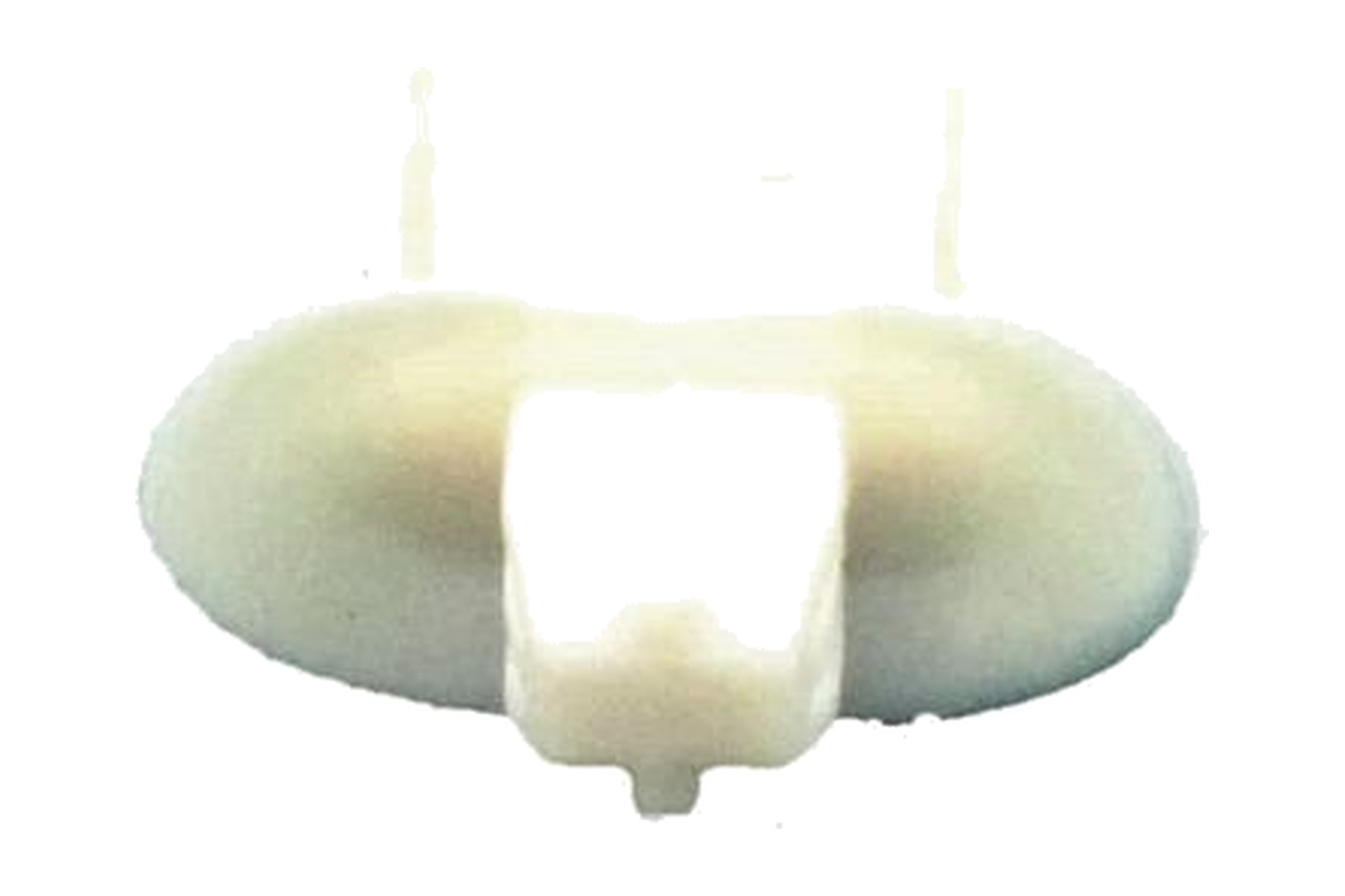 Presilha de Fixação de Revestimento de Coluna A VW 6N0867276 - Imagem 2